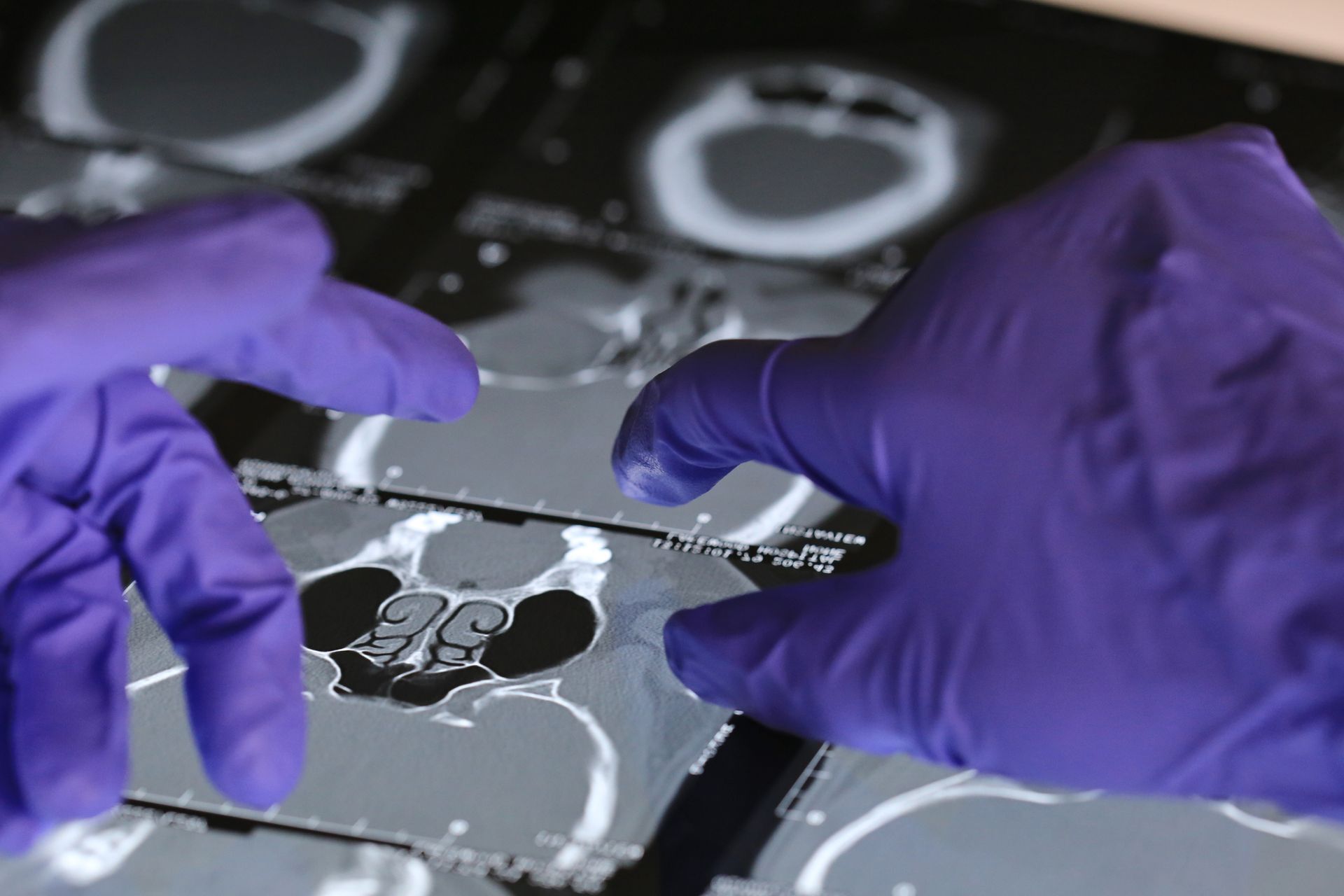 Cancer Screening | Frisco, TX | Signature Internal Medicine